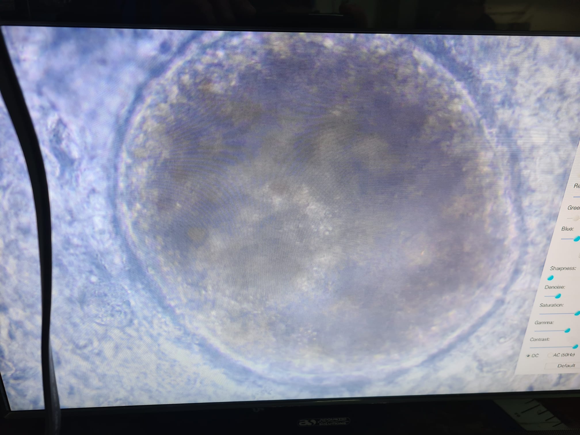 Elite Koi Fish Health - Whitespot Parasite